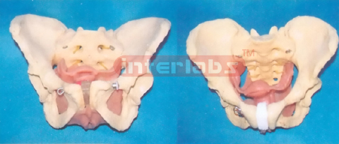 HEALTH PELVIS MODEL OF BOTH FEMALE AND MALE'S REPRODUCTIVE ORGANS